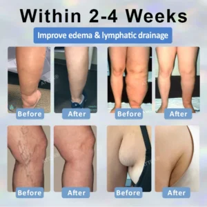 Alternative view of Black Cumin Edema Detox Herbal Cream