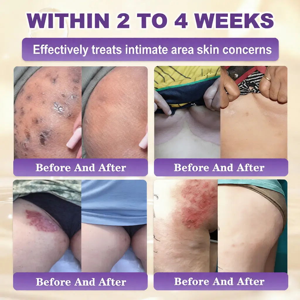 Biotin 10-in-1 Skin Restoration Cream - Image 4