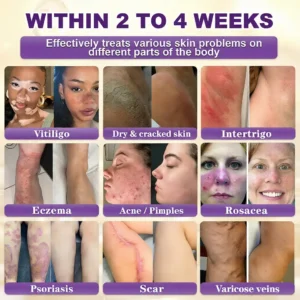 Alternative view of Biotin 10-in-1 Skin Restoration Cream