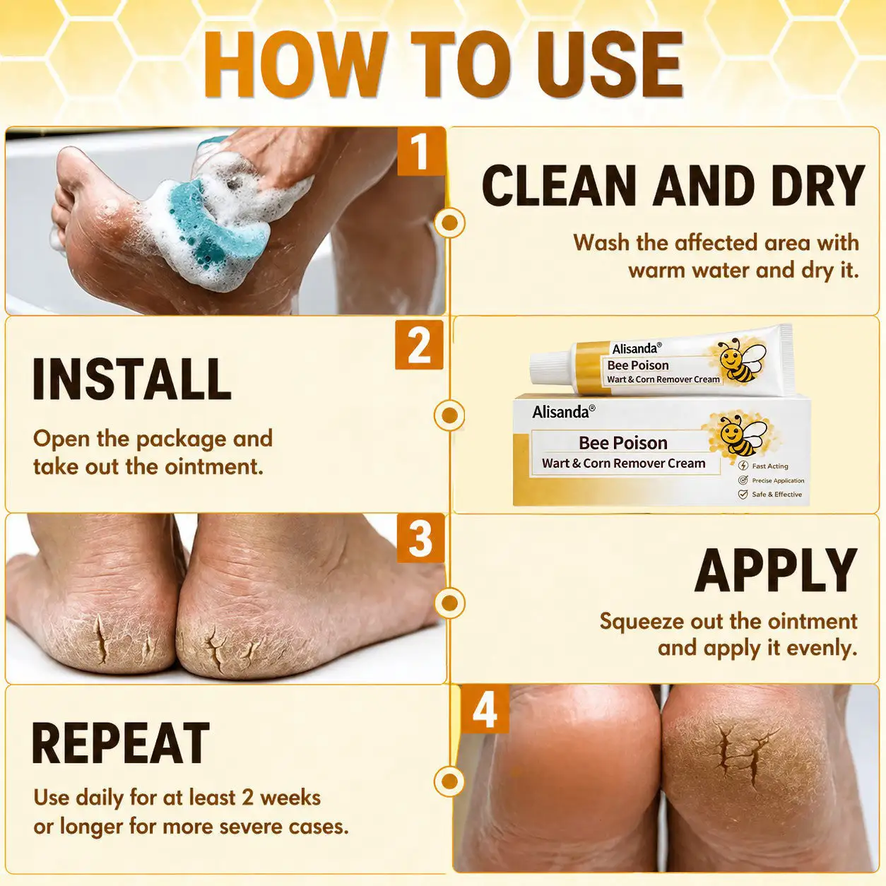 Bee Poison Wart & Corn Remover Cream - Image 7